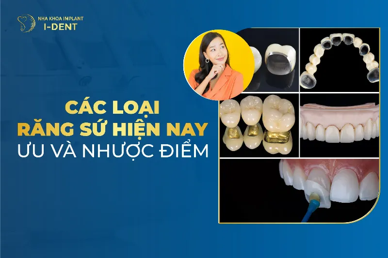Bảng so sánh độ cứng của các kim loại và hợp kim phổ biến